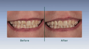 Dr. Sherberg case study smile image